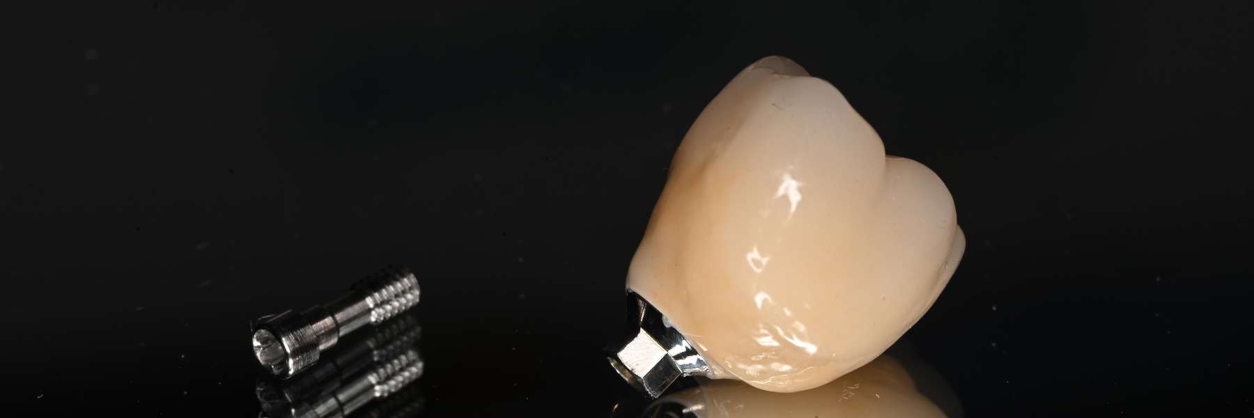Implants | Dentist